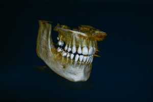 MeinZahnarzt Innsbruck - Digitale Aufnahme von Kiefer und Zähnen