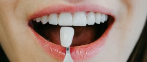 ästhetische Zahnmedizin