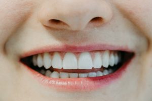 MeinZahnarzt Innsbruck - Strahlendes Lächeln Weiße Zähne Mundhygiene