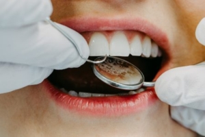 Mein Zahnarzt Innsbruck - Ästhetische Zahnmedizin Veneers Nahaufnahme Weiße Zähne