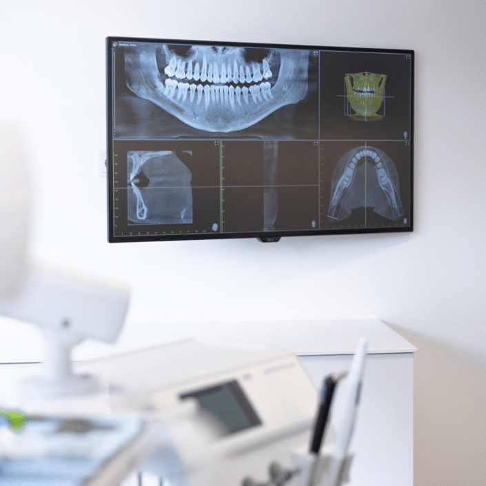MeinZahnarzt-Tirol_Zahnarzt-Innsbruck_kieferröntgen Röntgenbild in Behandlungszimmer | MeinZahnarzt Tirol