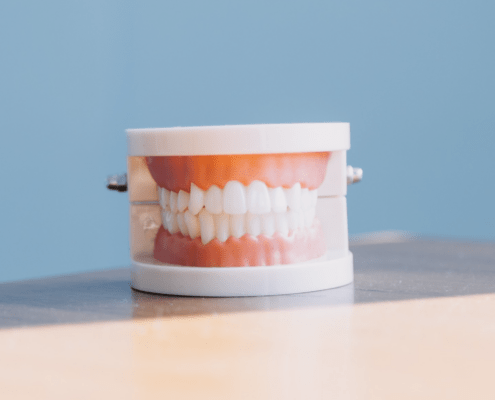 Dentalmodell | MeinZahnarzt Tirol