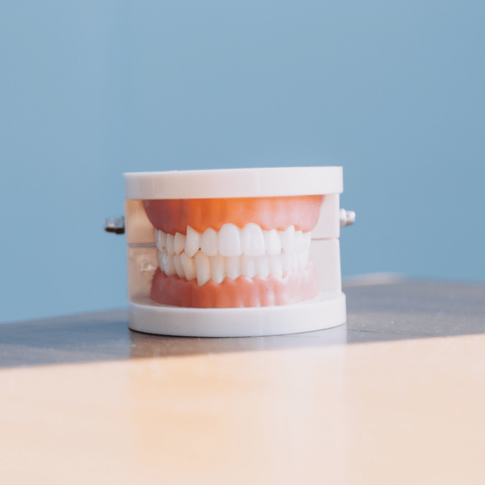 Dentalmodell | MeinZahnarzt Tirol
