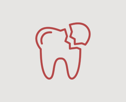 Zahnunfall – was tun, wenn ein Zahn rausfällt? - MeinZahnarzt Innsbruck